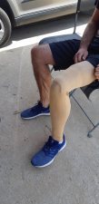 אבידן אורטופדיה שיקומית