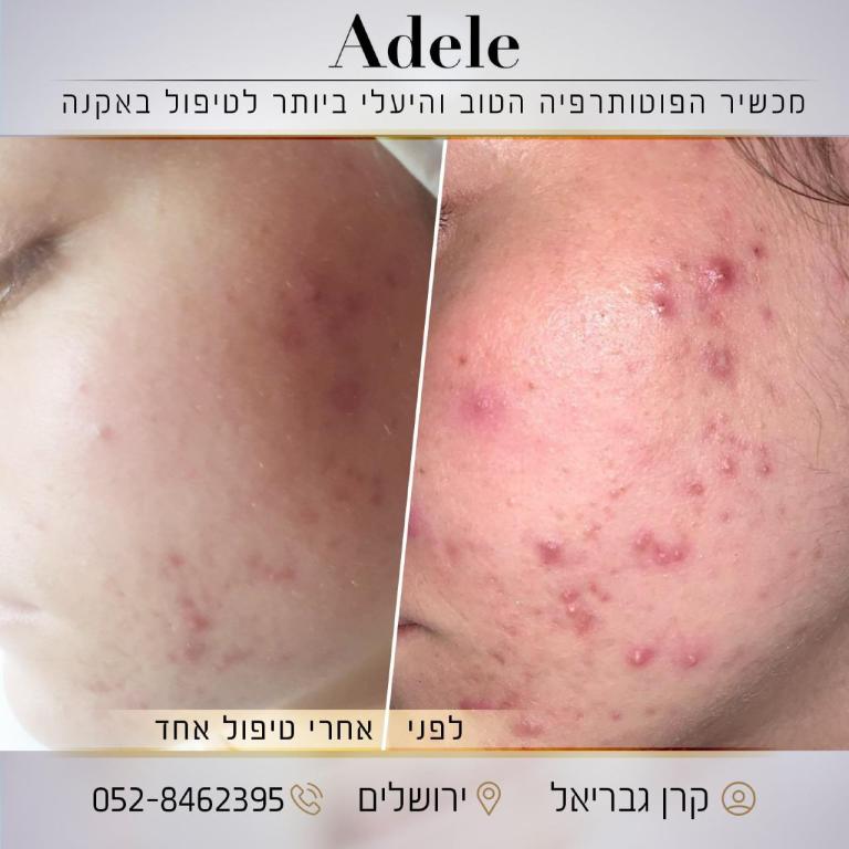 הדס שמריהו הדס שמריהו