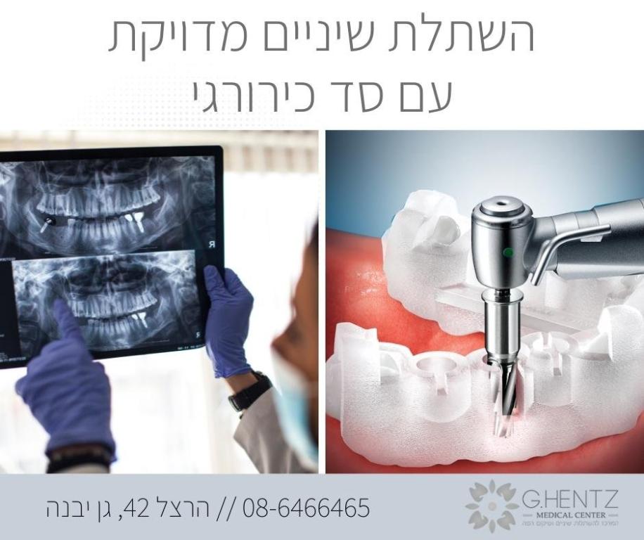 ד"ר חנץ גנדי ד"ר חנץ גנדי