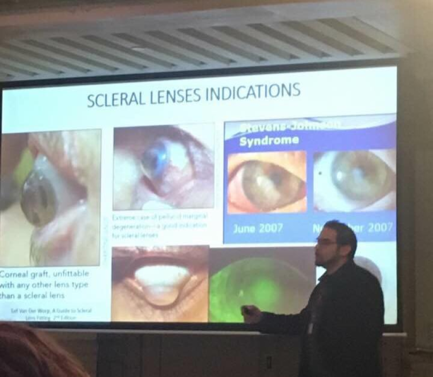 אופטיקה חדות ראייה אופטיקה חדות ראייה