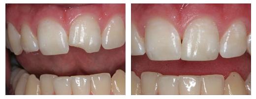 ד"ר אברבנאל גליה ד"ר אברבנאל גליה