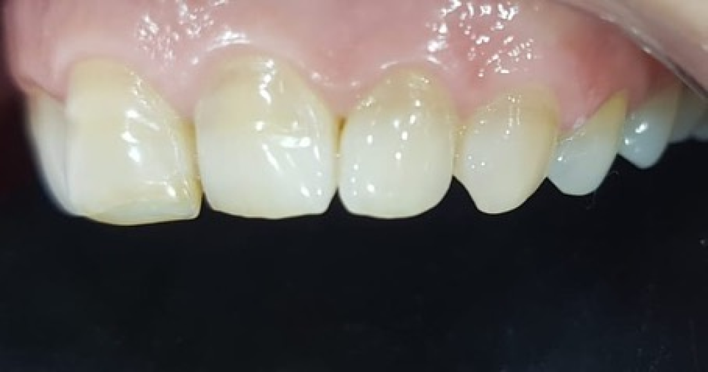 ד"ר גלעד פיסקוס אסתטיקה דנטלית ד"ר גלעד פיסקוס אסתטיקה דנטלית