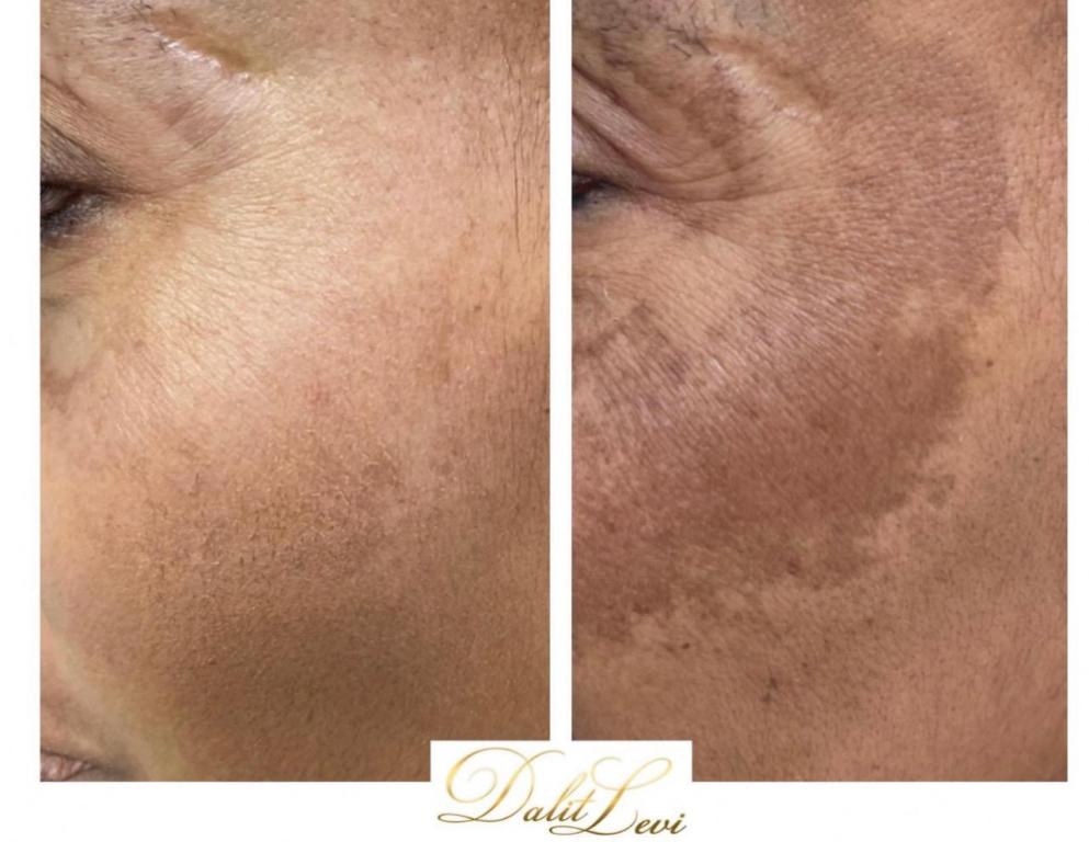 דלית לוי דלית לוי