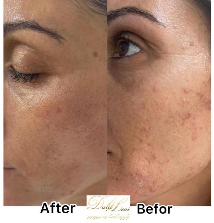 דלית לוי דלית לוי