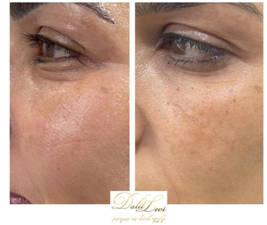 דלית לוי דלית לוי