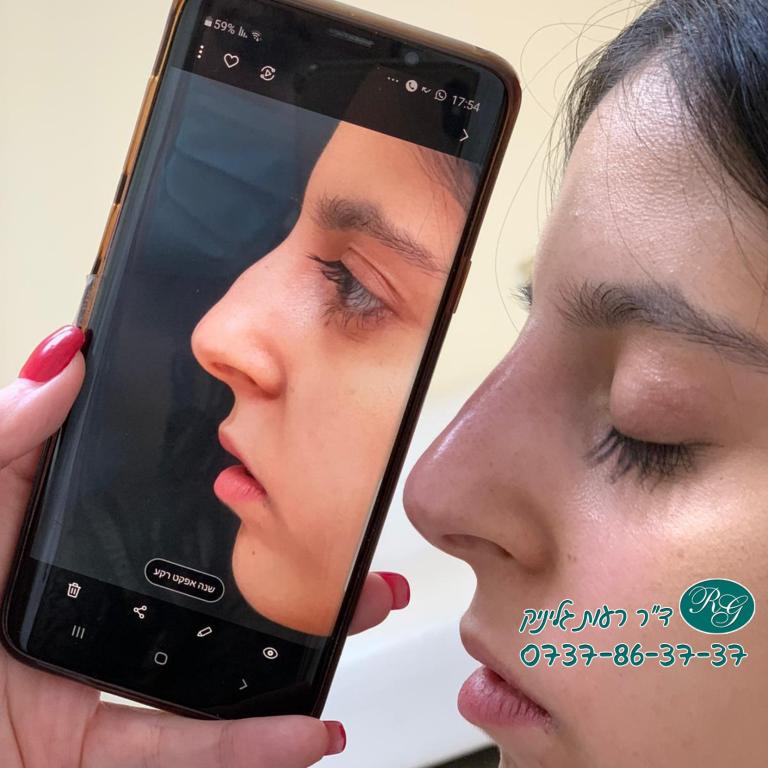 ד"ר רעות גליניק ד"ר רעות גליניק