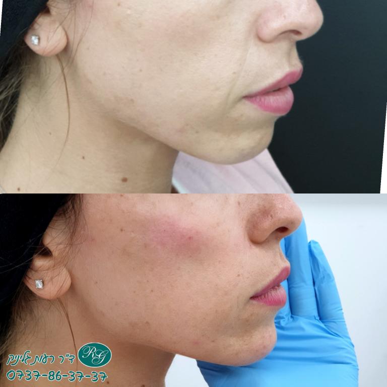 ד"ר רעות גליניק ד"ר רעות גליניק