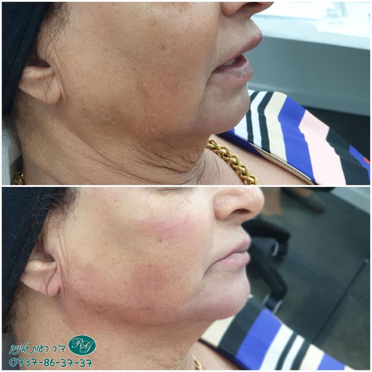 ד"ר רעות גליניק ד"ר רעות גליניק