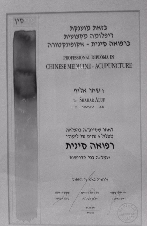 דיקור סיני בראש העין שחר אלוף דיקור סיני בראש העין שחר אלוף