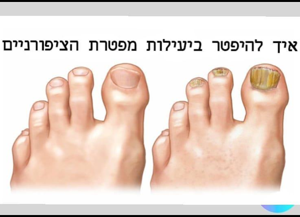 שרונה יוסף טיפוח ובריאות שרונה יוסף טיפוח ובריאות