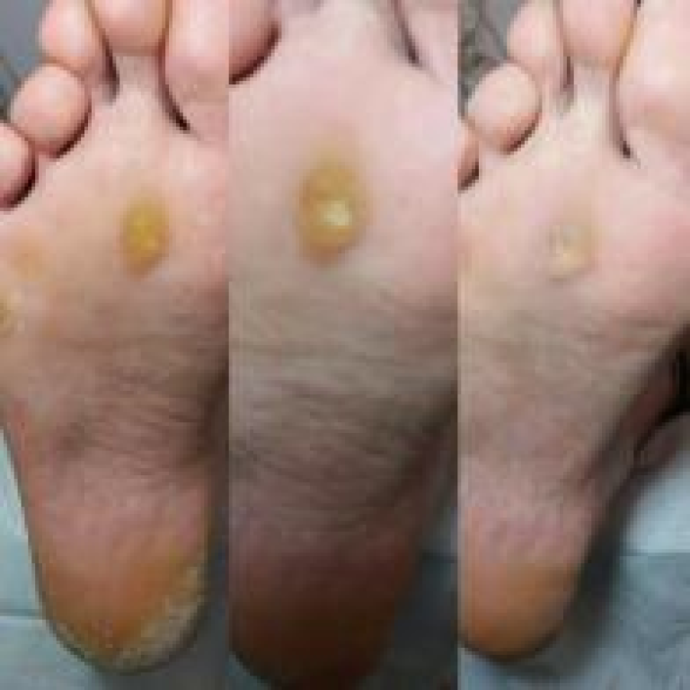 שרונה יוסף טיפוח ובריאות שרונה יוסף טיפוח ובריאות