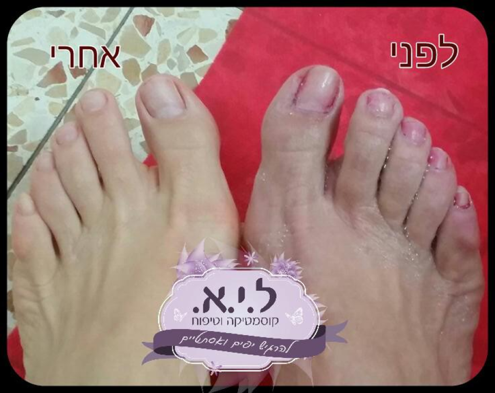 ל.י.א. קוסמטיקה וטיפוח ל.י.א. קוסמטיקה וטיפוח