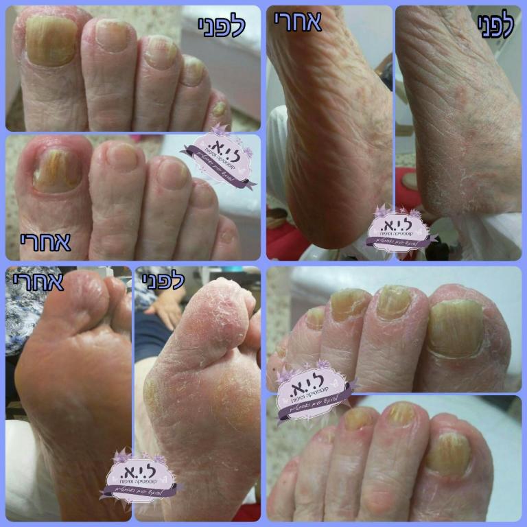 ל.י.א. קוסמטיקה וטיפוח ל.י.א. קוסמטיקה וטיפוח