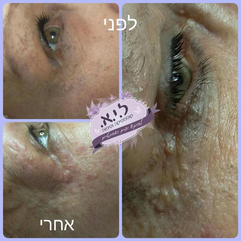 ל.י.א. קוסמטיקה וטיפוח ל.י.א. קוסמטיקה וטיפוח