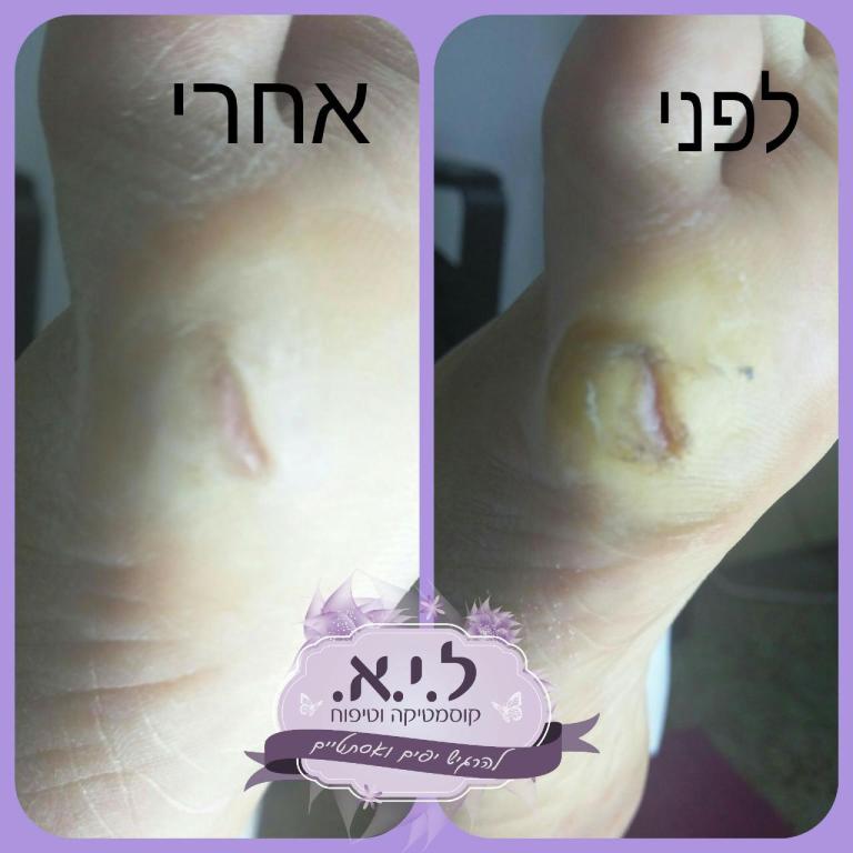 ל.י.א. קוסמטיקה וטיפוח ל.י.א. קוסמטיקה וטיפוח