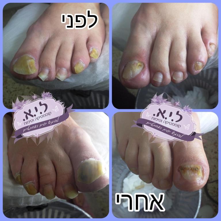 ל.י.א. קוסמטיקה וטיפוח ל.י.א. קוסמטיקה וטיפוח