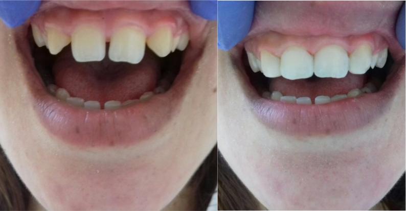 מרפאת שיניים דנטל וורלד קליניק מרפאת שיניים דנטל וורלד קליניק