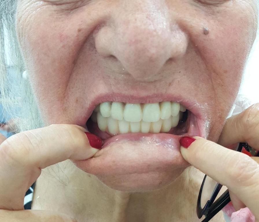 משה אליק מעבדת שיניים משה אליק מעבדת שיניים