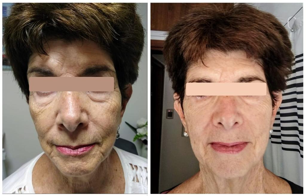 רימה קיגלמן רפואה סינית רימה קיגלמן רפואה סינית