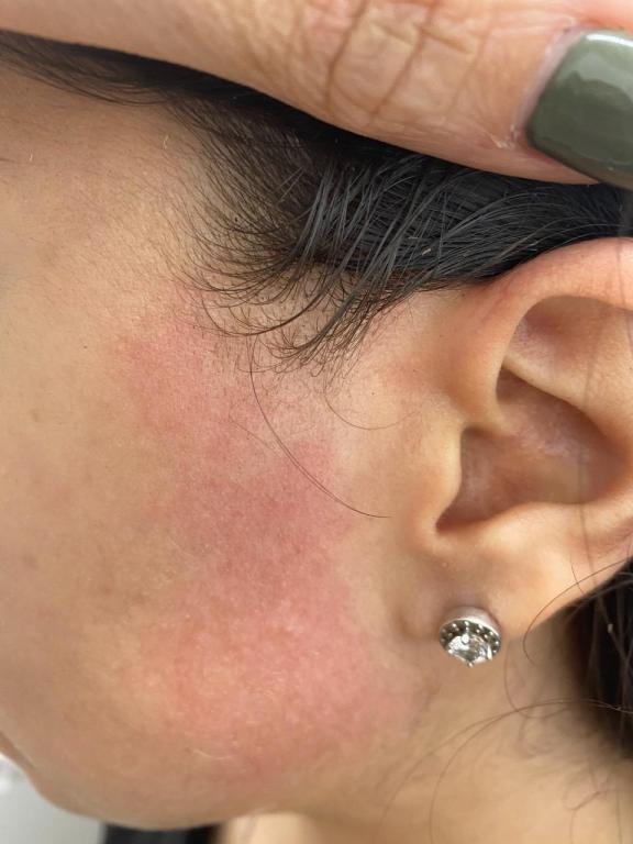 סיל לייזר סיל לייזר