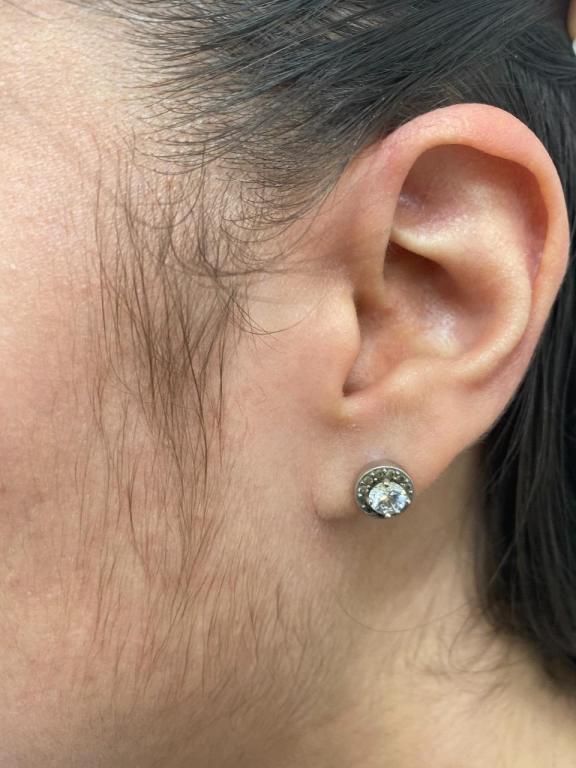 סיל לייזר סיל לייזר