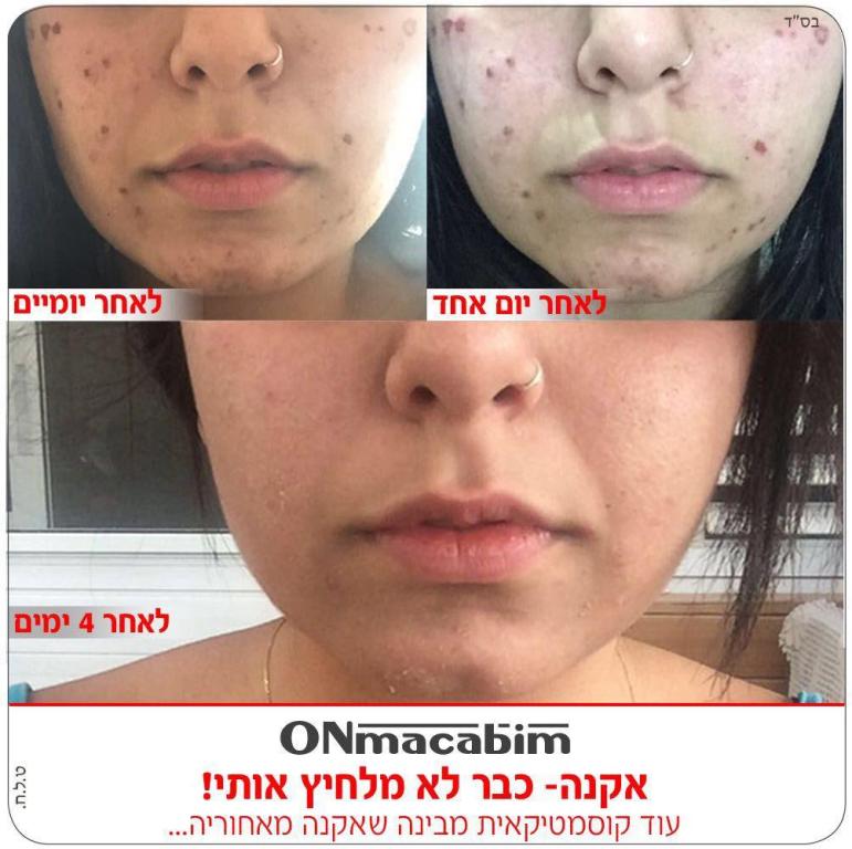 k.a קוסמטיקה k.a קוסמטיקה