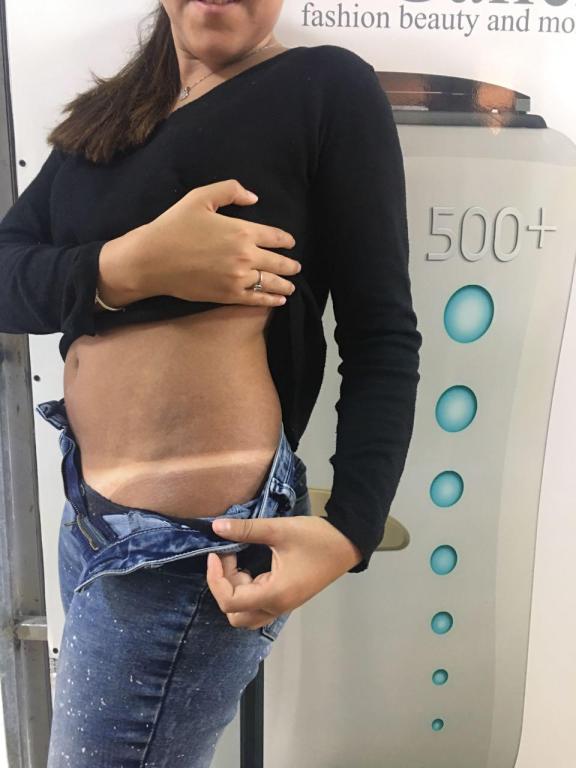 שיזוף נתניה שיזוף נתניה