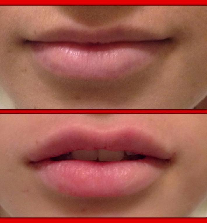 BU נעמה קסרי BU נעמה קסרי