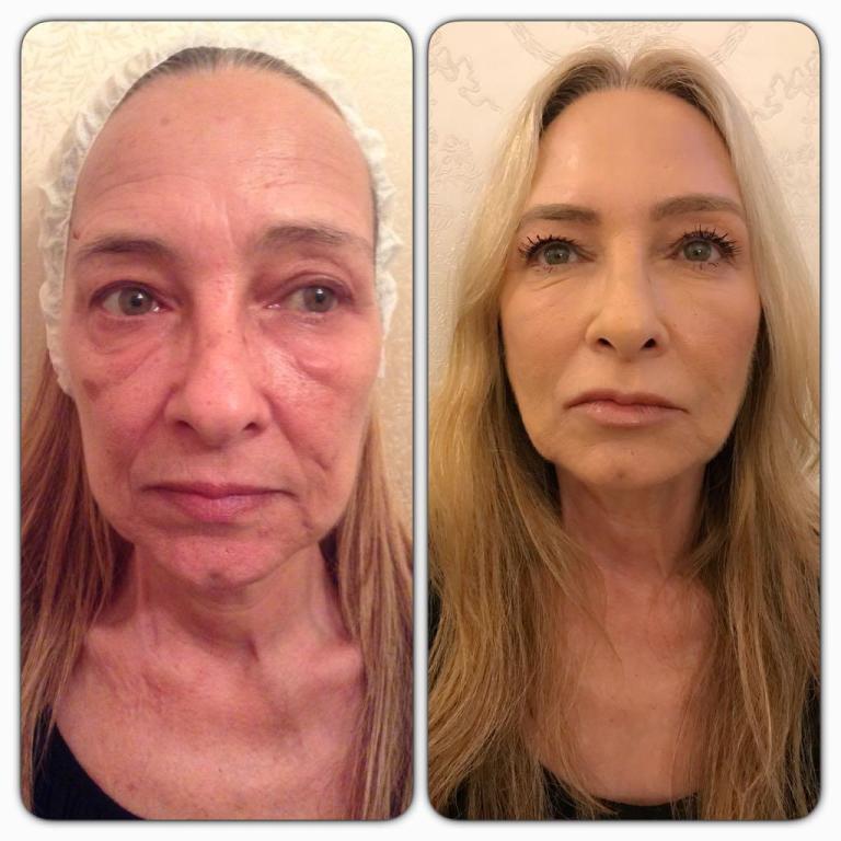 BU נעמה קסרי BU נעמה קסרי