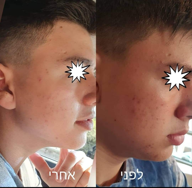 אורון אבידן קוסמטיקאי רפואי אורון אבידן קוסמטיקאי רפואי