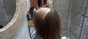 Hairfix