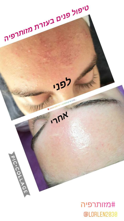 lorlen cosmetics lorlen cosmetics