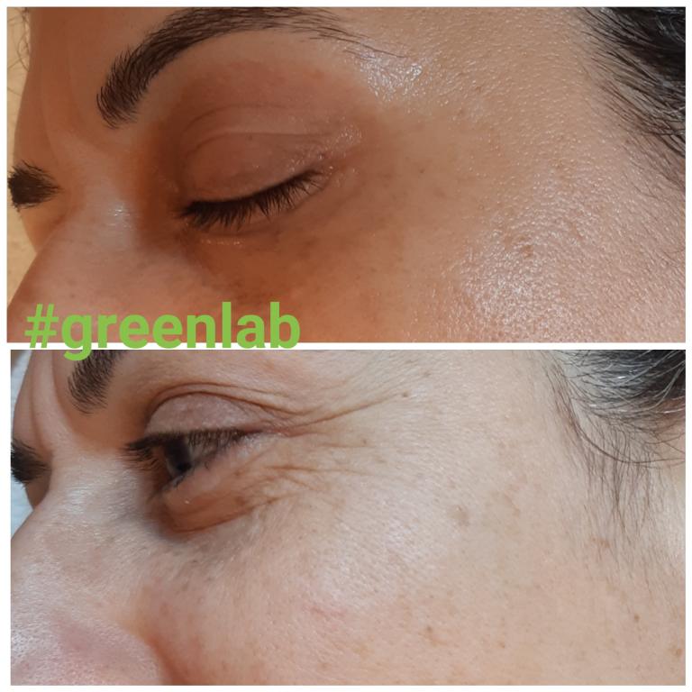 שלי קרפלד שלי קרפלד