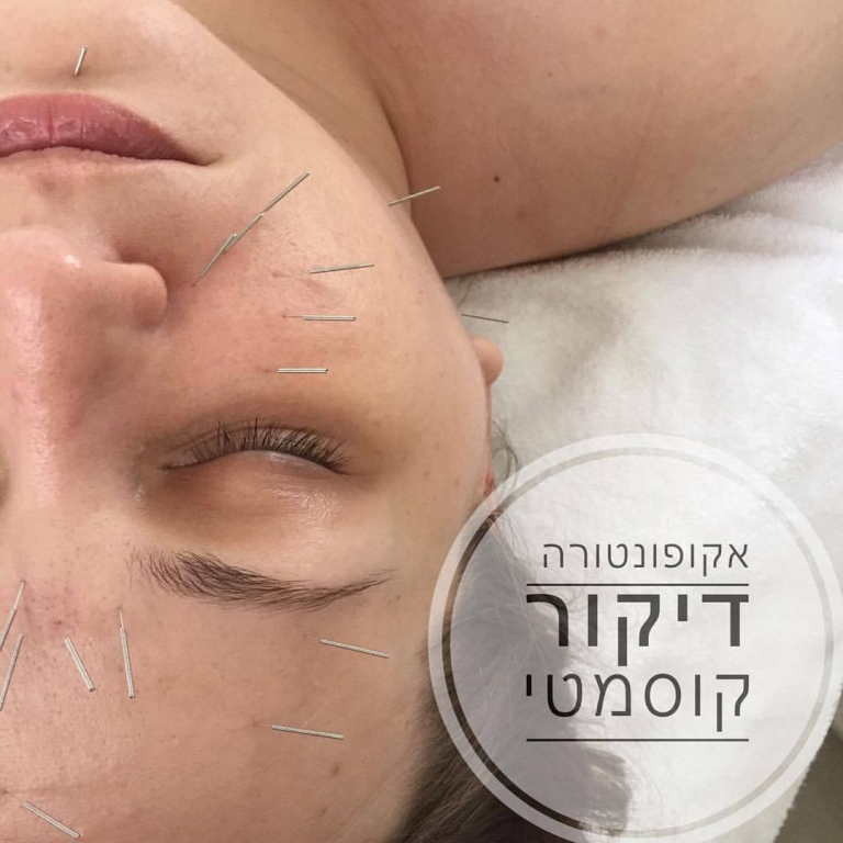 אלונה נובה אלונה נובה