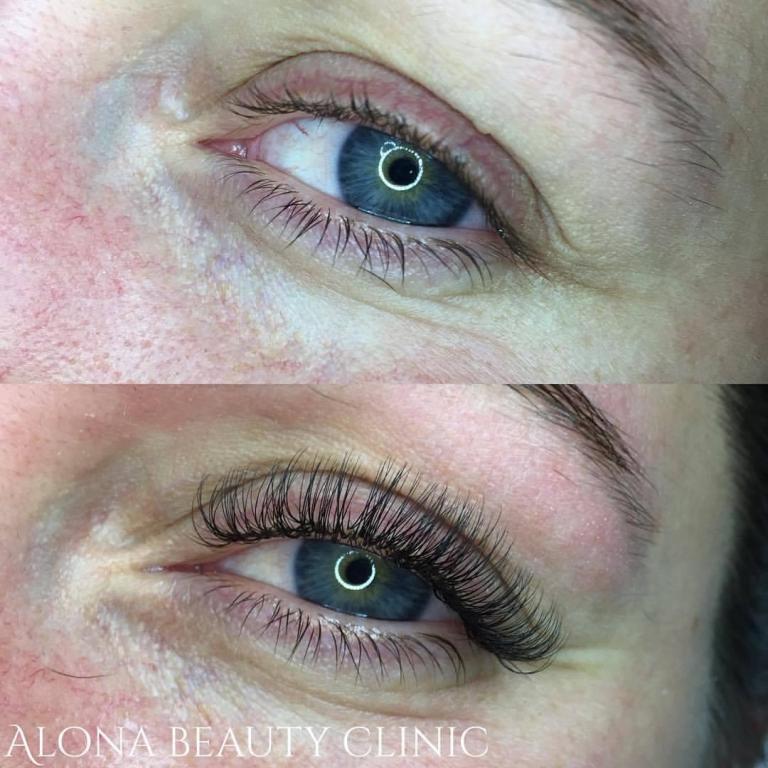 אלונה נובה אלונה נובה