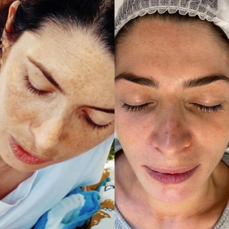 אלונה נובה אלונה נובה