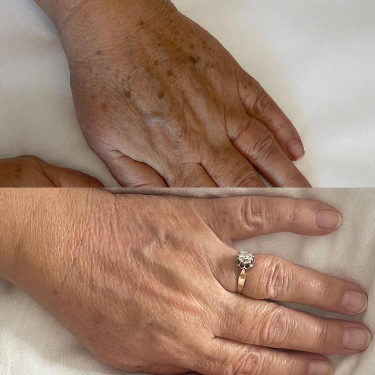 אלונה נובה אלונה נובה