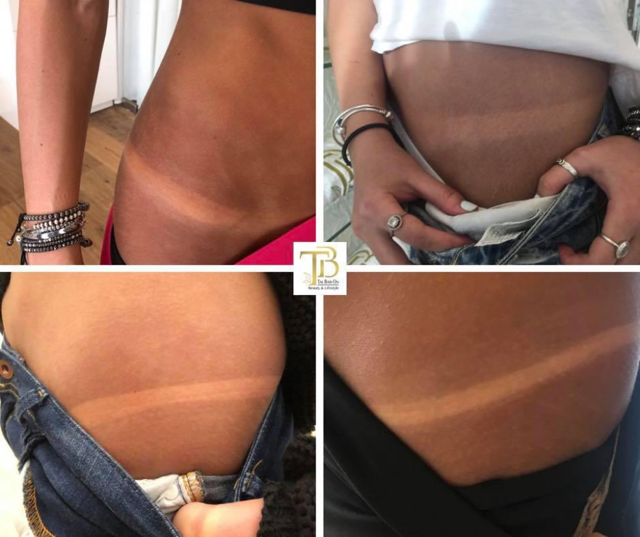 טל בר און טל בר און