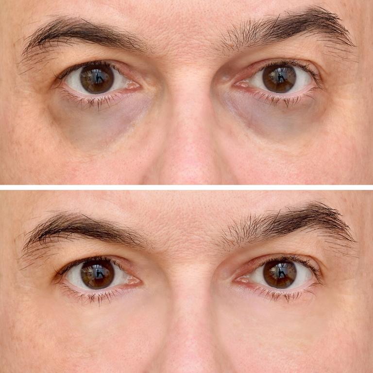 ד"ר מור אסתטיקה ד"ר מור אסתטיקה