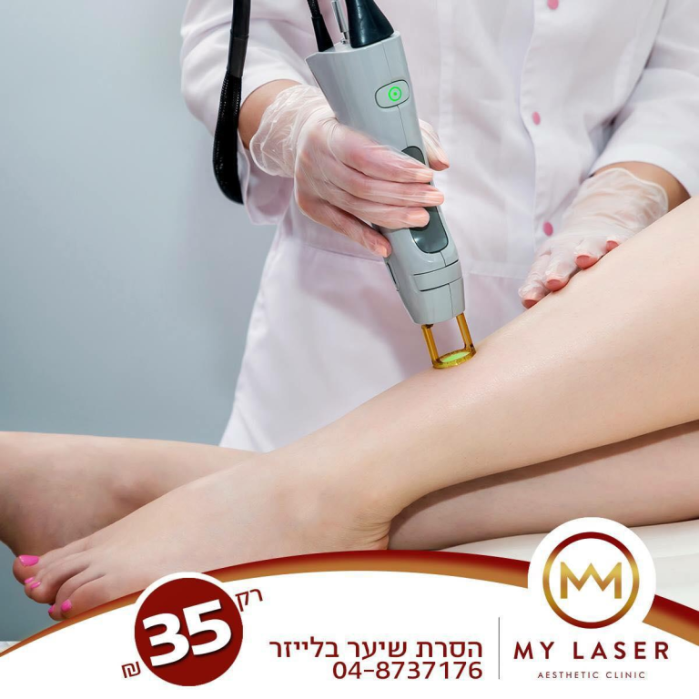 מאי לייזר מאי לייזר