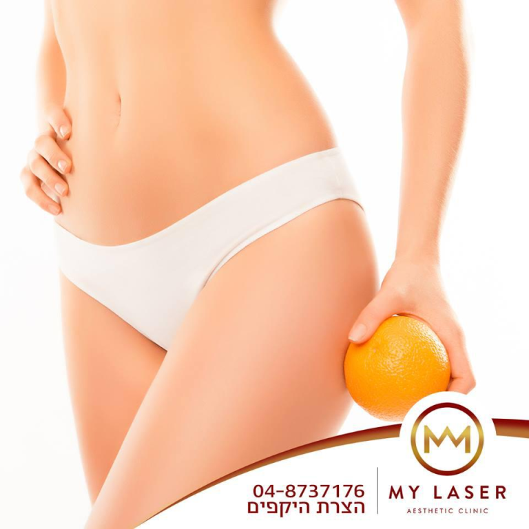 מאי לייזר מאי לייזר