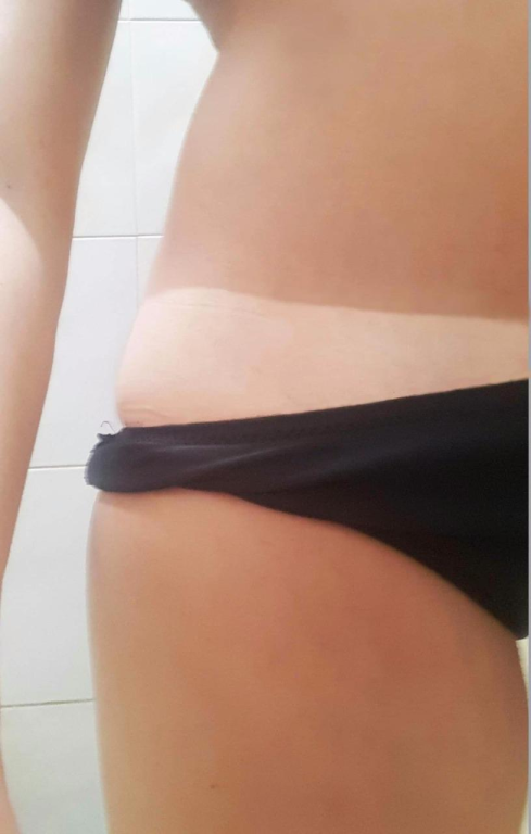 שייני שיזוף בהתזה שייני שיזוף בהתזה