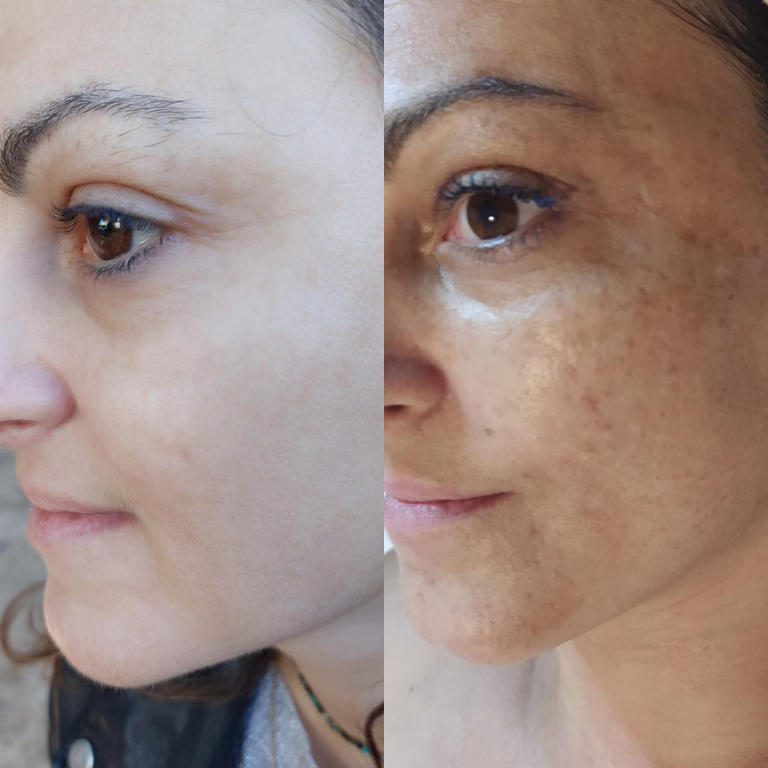 Karinda skin care Karinda skin care