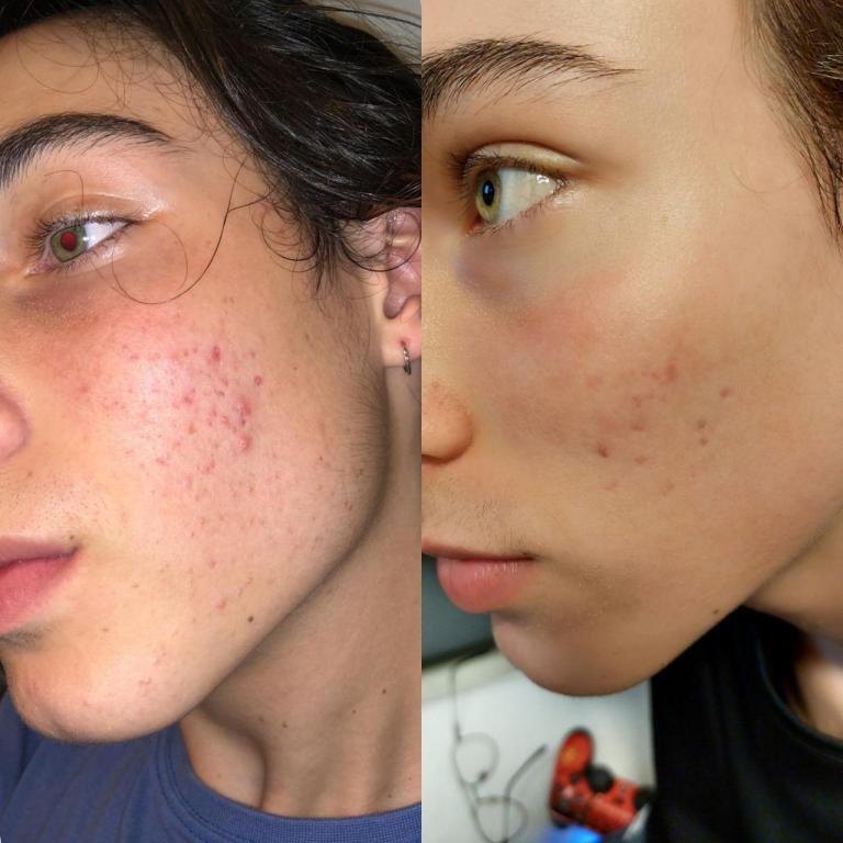 Karinda skin care Karinda skin care