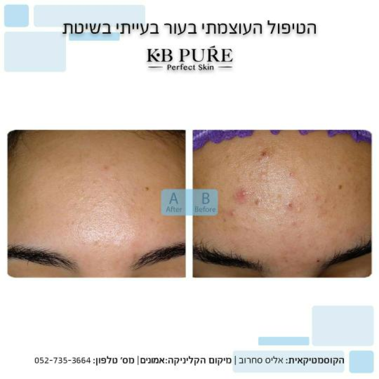 Alice Wonderland Alice Wonderland