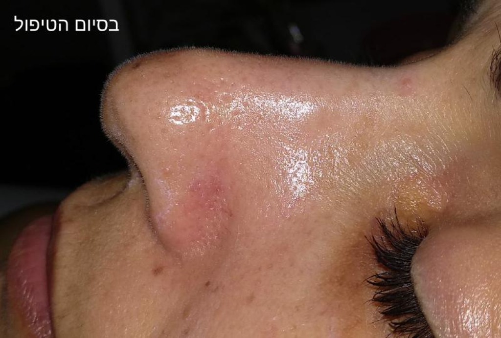 Alice Wonderland Alice Wonderland