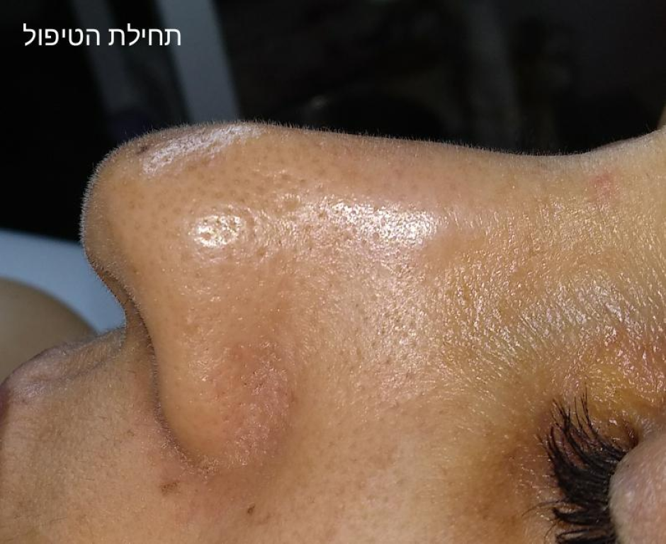 Alice Wonderland Alice Wonderland