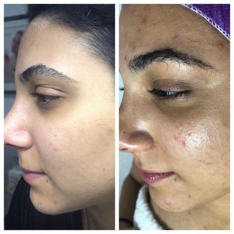 מעיין דעוס קוסמטיקאית פרא רפואית מעיין דעוס קוסמטיקאית פרא רפואית