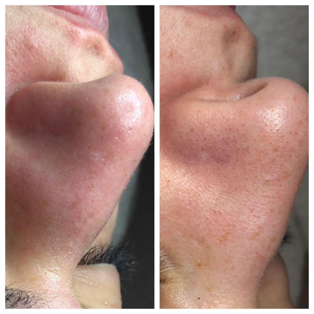 מעיין דעוס קוסמטיקאית פרא רפואית מעיין דעוס קוסמטיקאית פרא רפואית