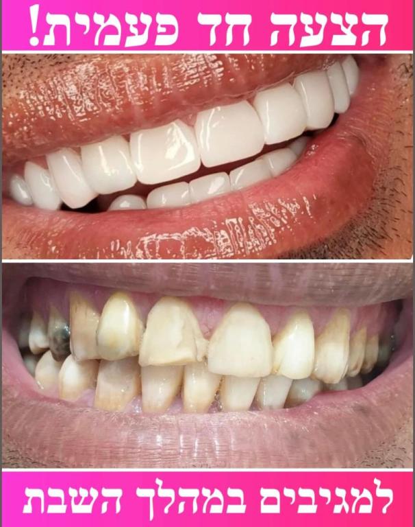 סמייל קליניק סמייל קליניק